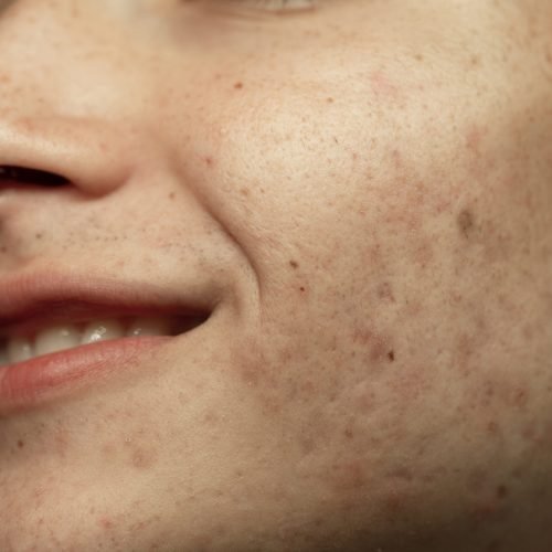side-view-smiley-man-skin-texture